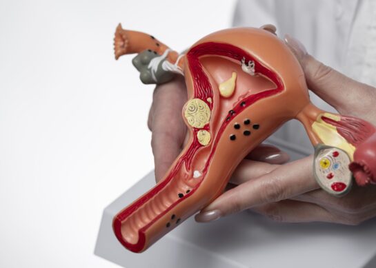 Especialistas en VPH